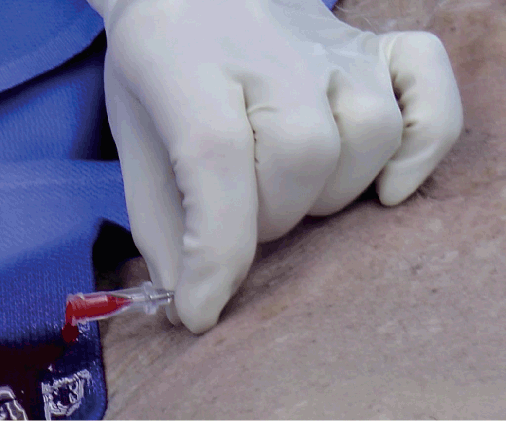 Procedures (Section 2) - Color Atlas of Emergency Trauma