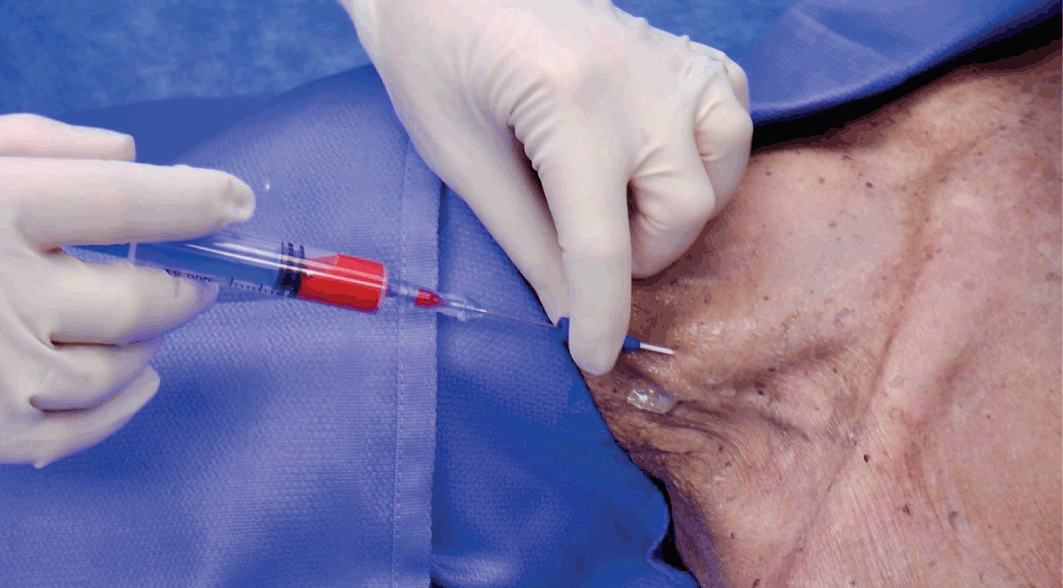 Procedures (Section 2) - Color Atlas of Emergency Trauma