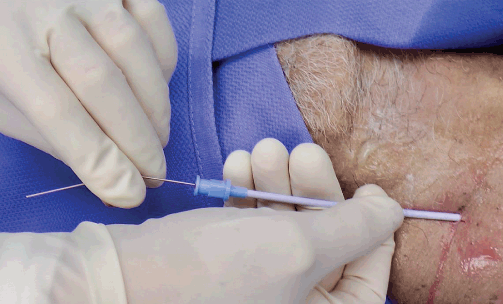 Procedures (Section 2) - Color Atlas of Emergency Trauma