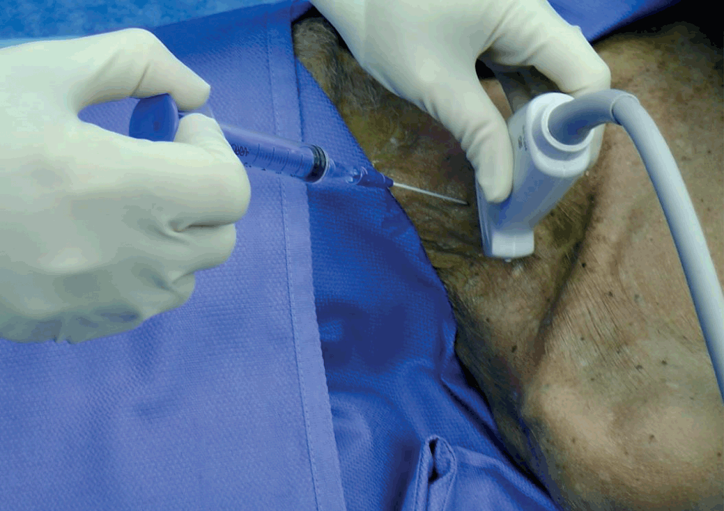 Procedures (Section 2) - Color Atlas of Emergency Trauma
