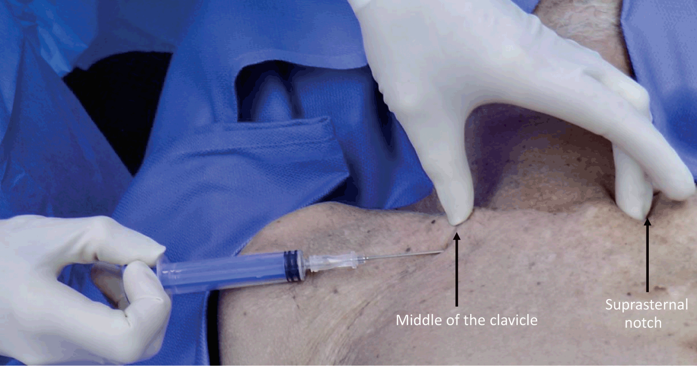 Procedures (Section 2) - Color Atlas of Emergency Trauma
