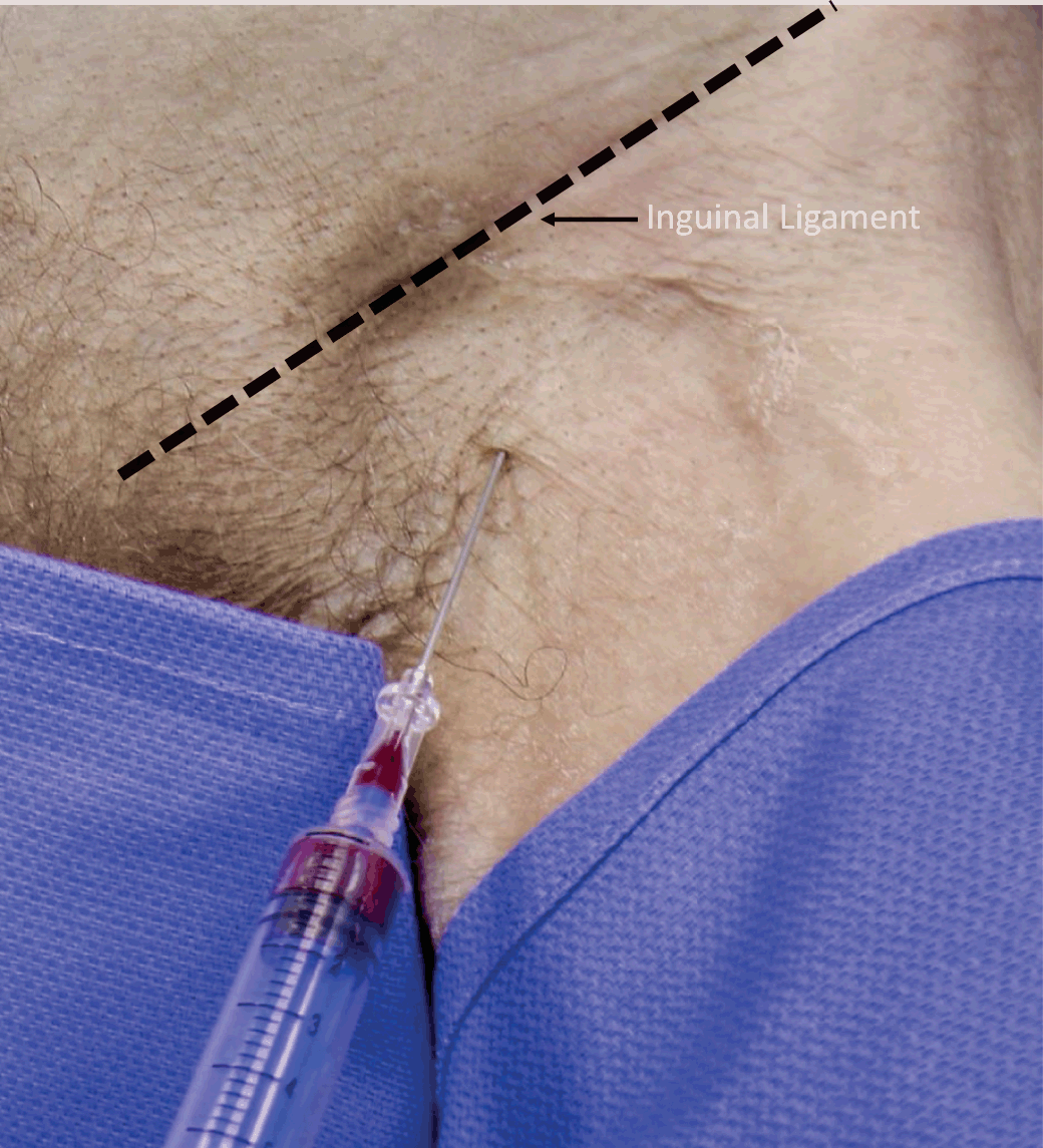 Procedures (Section 2) - Color Atlas of Emergency Trauma
