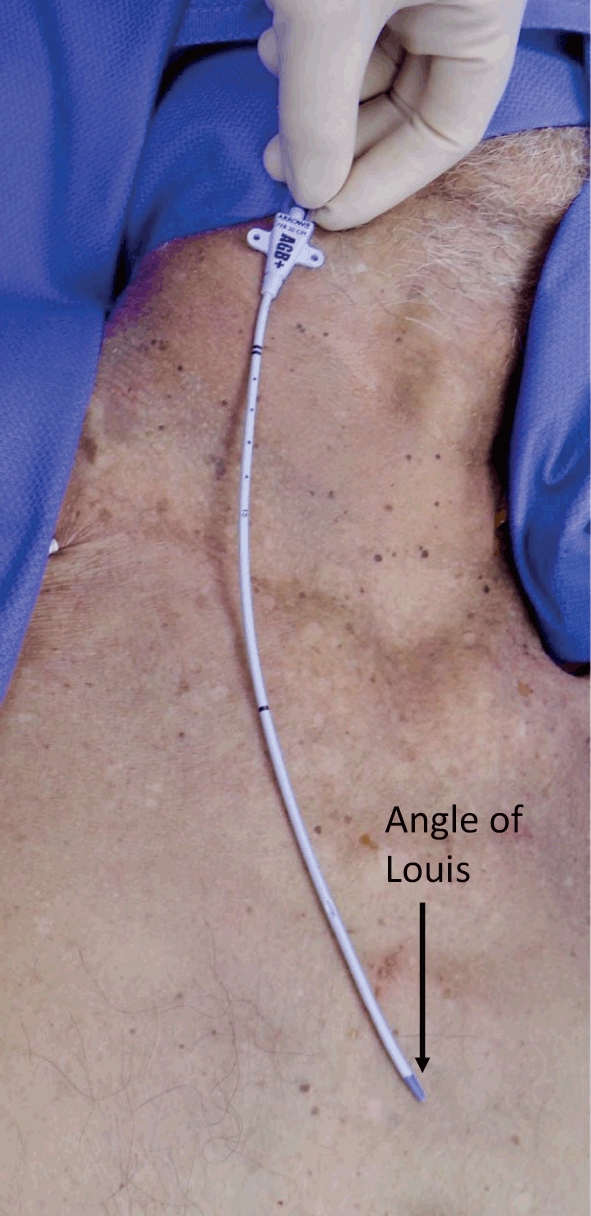 Procedures (Section 2) - Color Atlas of Emergency Trauma