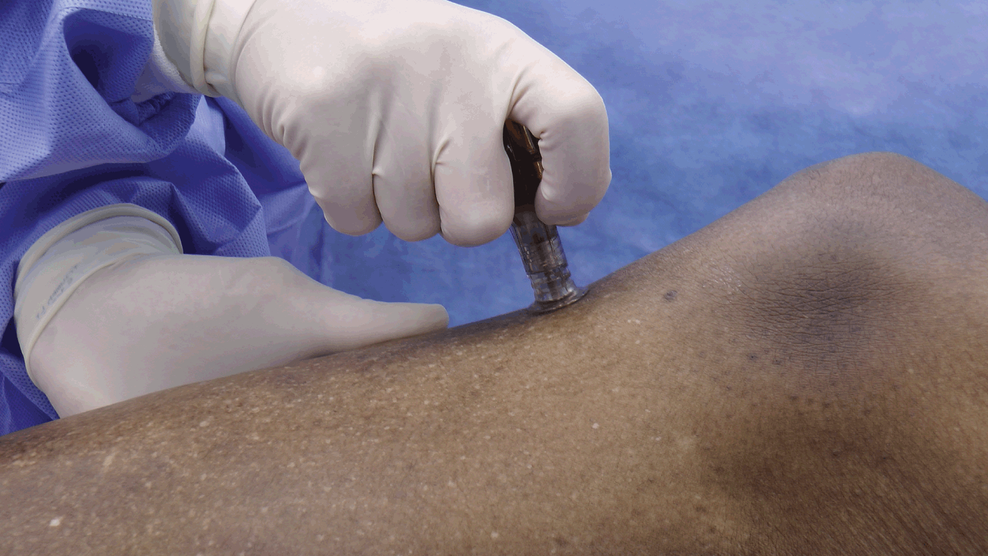Procedures (Section 2) - Color Atlas of Emergency Trauma