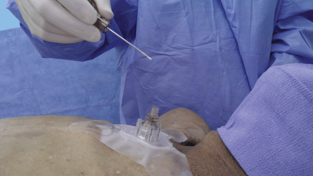 Procedures (Section 2) - Color Atlas of Emergency Trauma