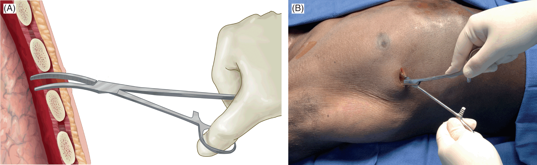 Procedures (Section 2) - Color Atlas of Emergency Trauma