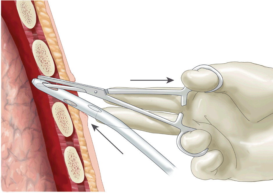 Procedures (Section 2) - Color Atlas of Emergency Trauma
