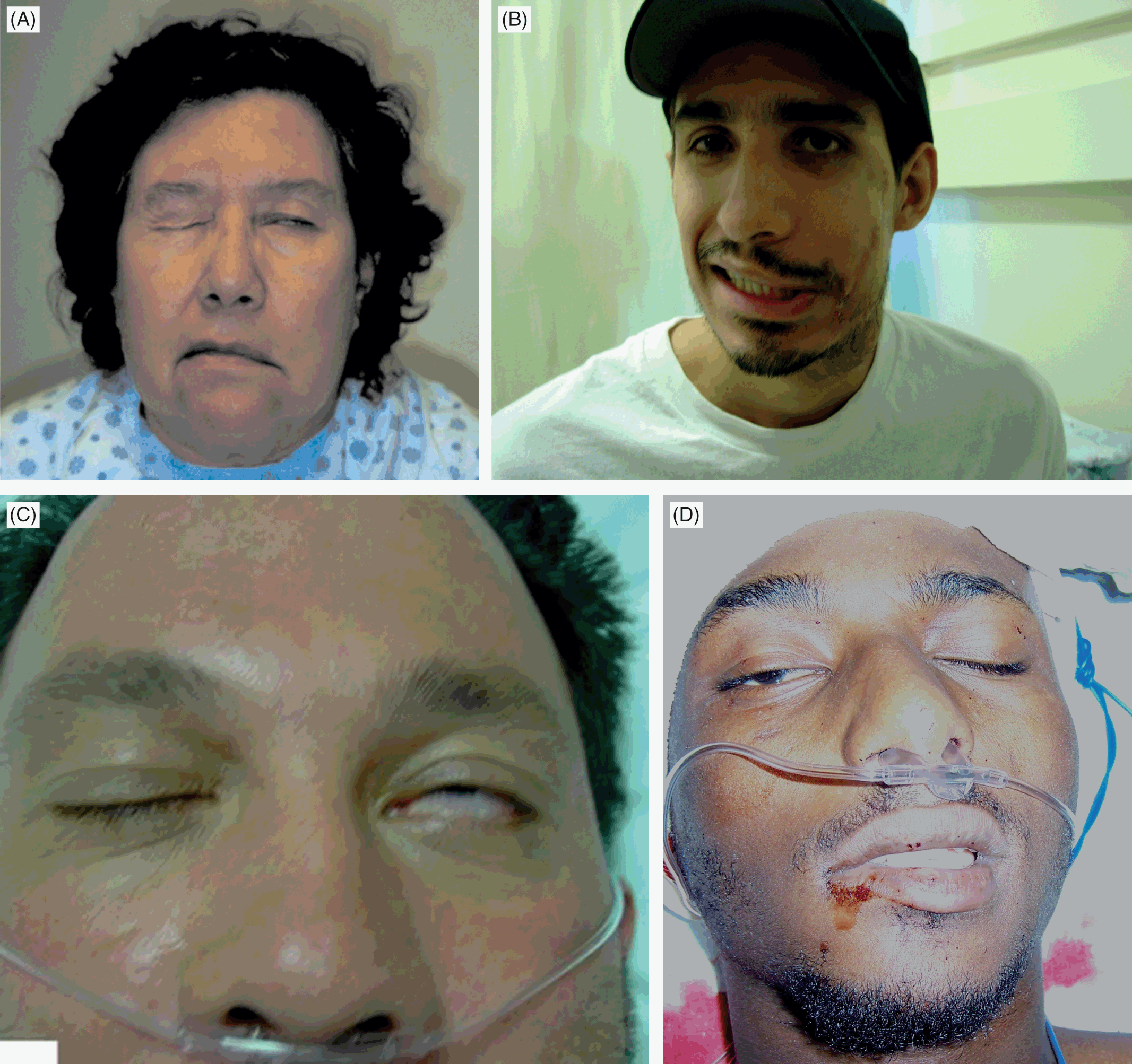 Facial Injury (Chapter 2) - Color Atlas of Emergency Trauma, image size:2133x2006