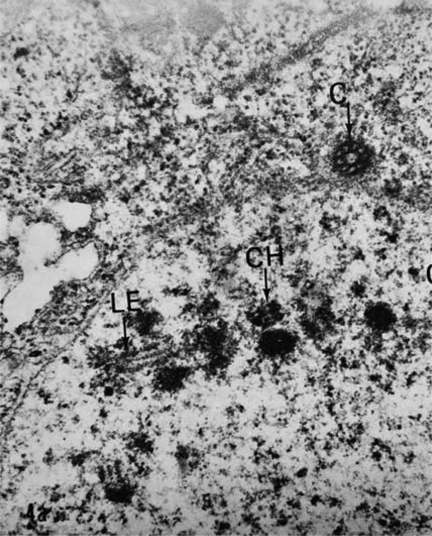 Loss Of The Central Rachis And Synaptonemal Complexes During Meiotic Prophase In Female Ascaris