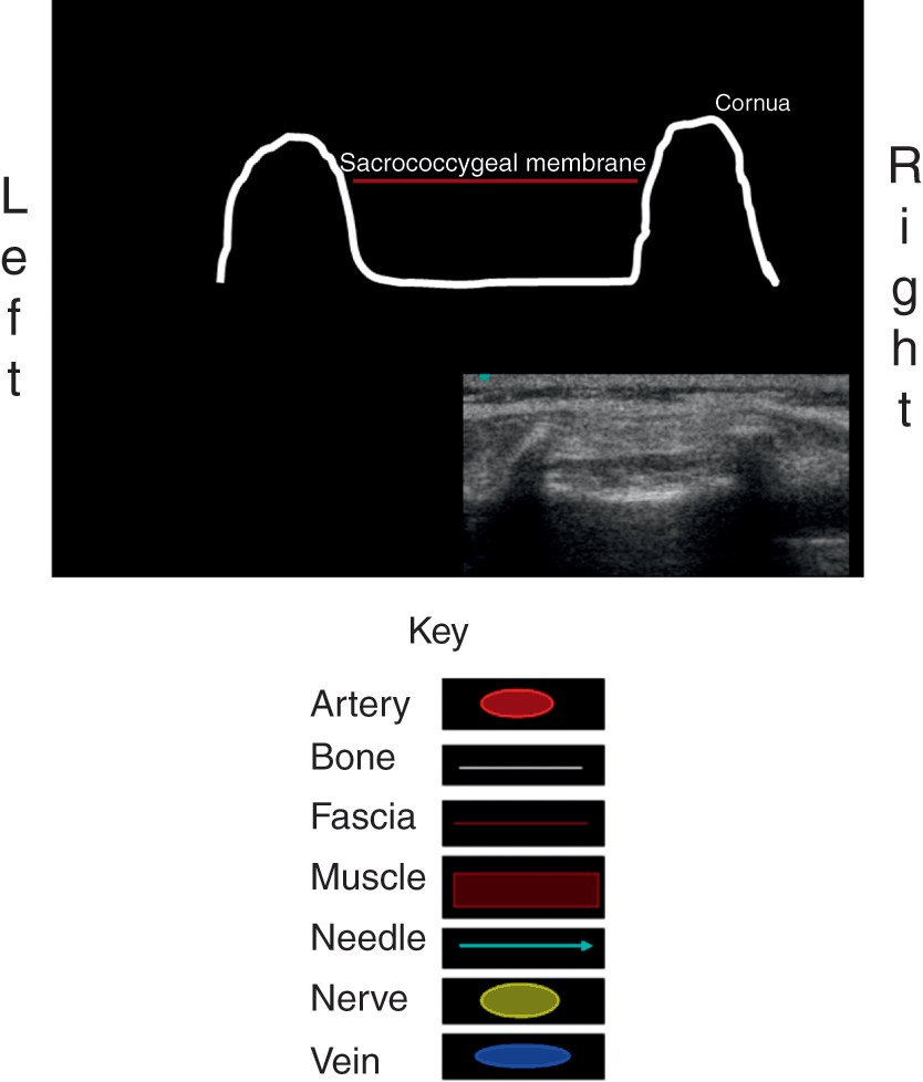 MPR Knee Bolster - MPR Orthopedics