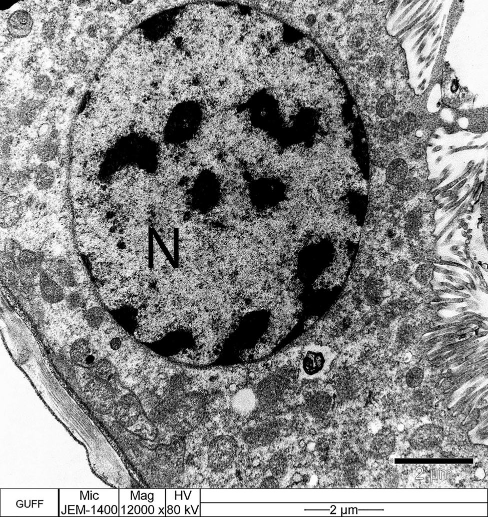 Histomorphology Of The Malpighian Tubules And The Chemical Composition 