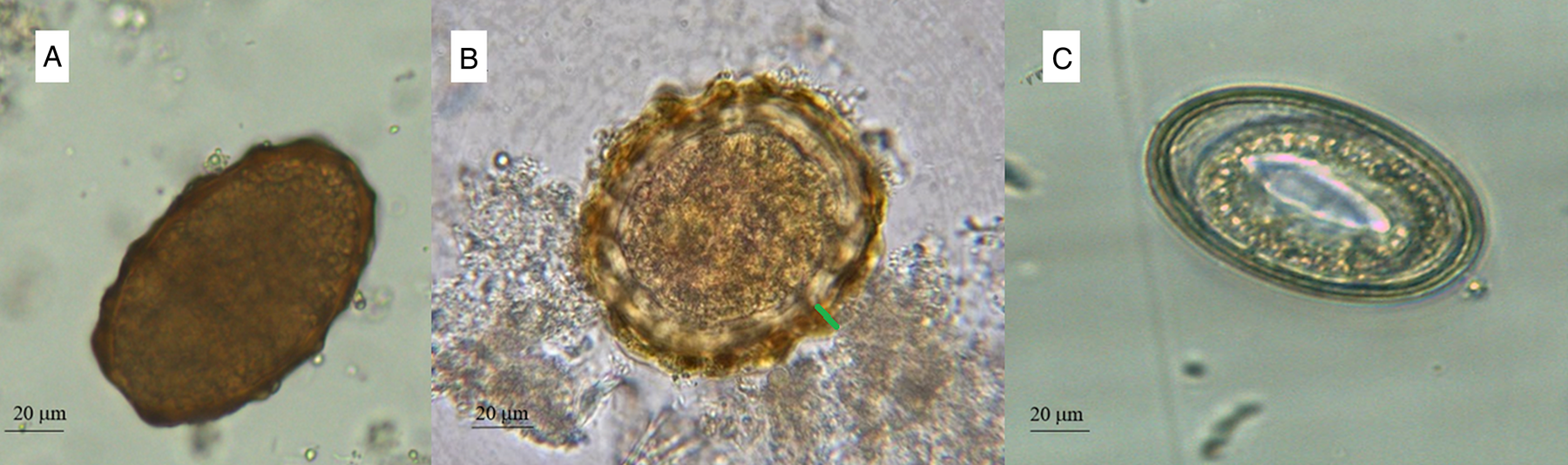 ascaris lumbricoides fertilized egg