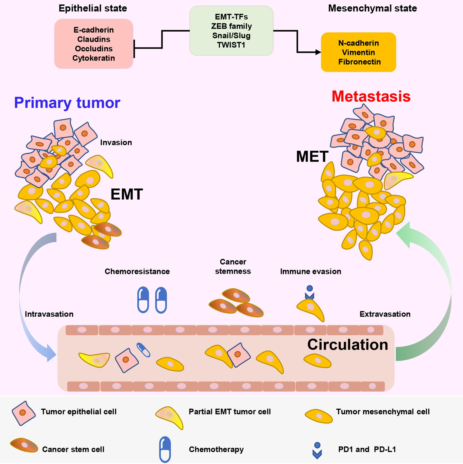 epithelial mesenchymal transition cancer
