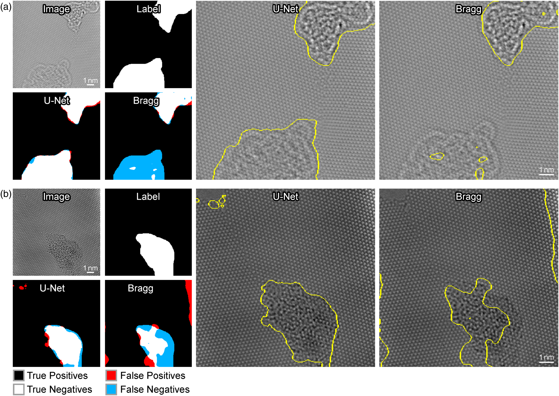 Deep Learning Segmentation of Complex Features in Atomic