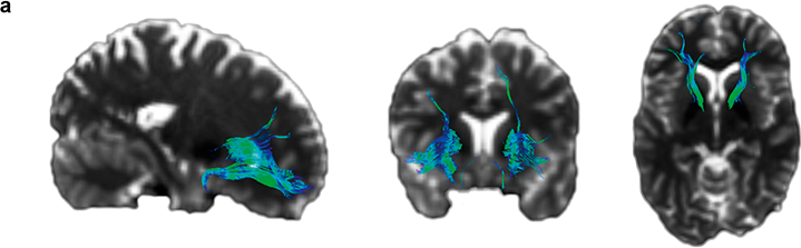 Childhood and Adolescence: The Development of Human Thinking