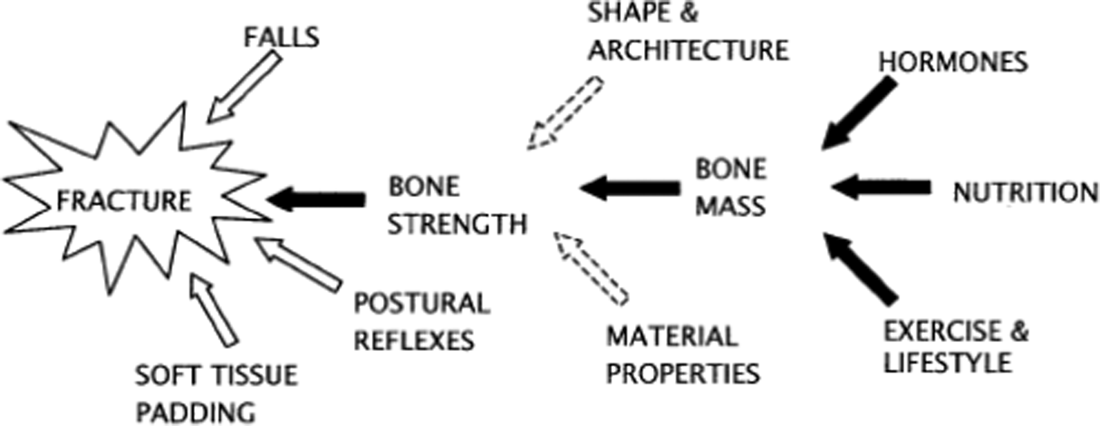 High Bone Mass - ScienceDirect