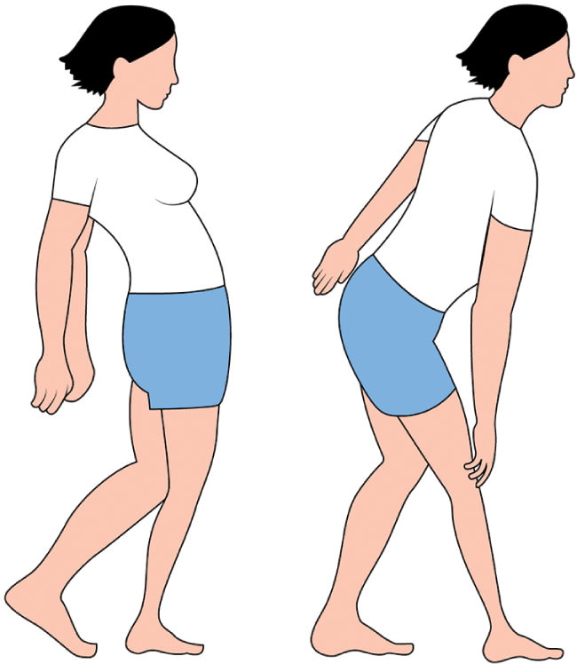 Post-op Hip Abduction Brace, Hip Replacement Lower Limbs Extremity  Paralysis Fixed, Hip Abduction Fixtion Orthosis for Dislocation of Hip  Joint Leg
