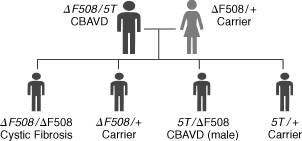 Genetic disorders that cause male infertility - Ziva Fertility