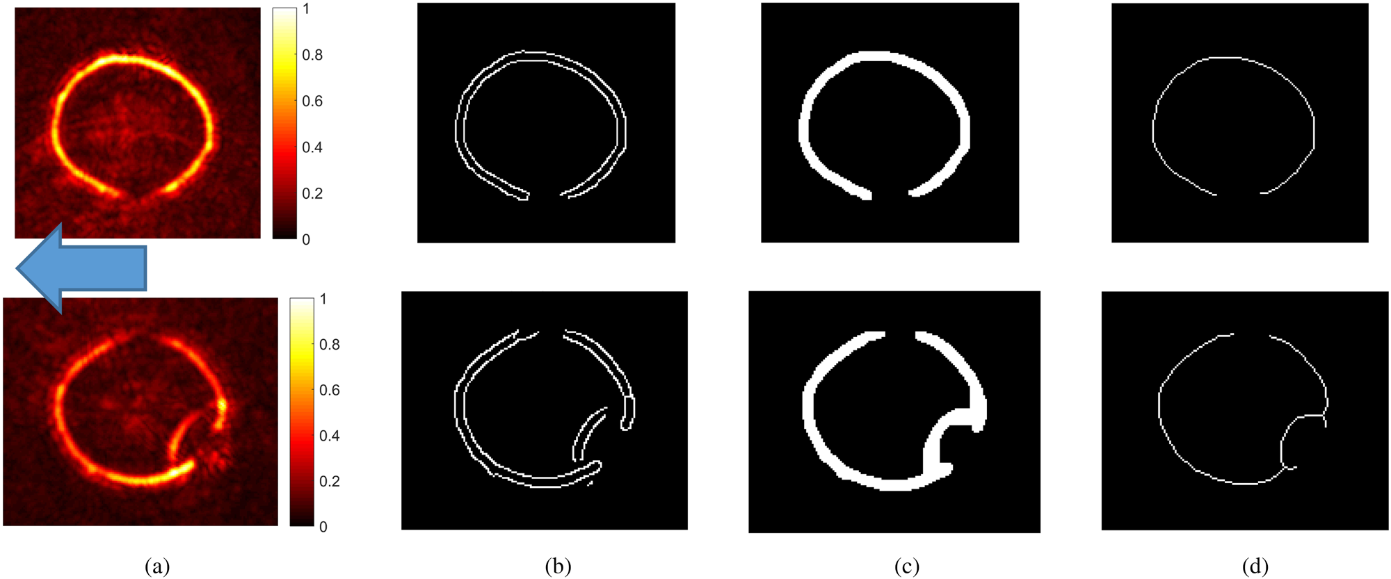 Determining The Nominal Body Contour Image Using Wideband Millimeter ...