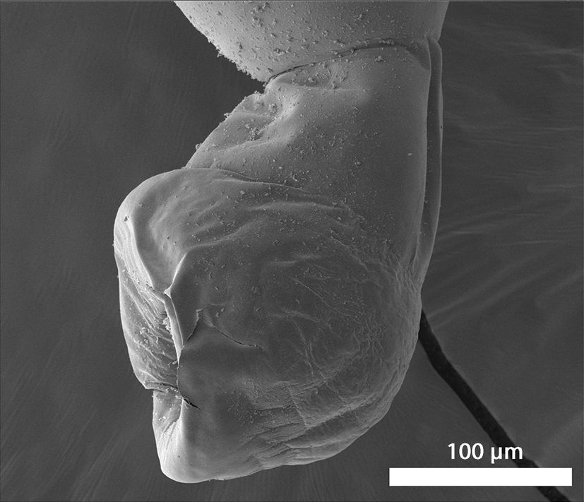 New perspectives of Microsentis wardae Martin & Multani, 1966  (Acanthocephala: Neoechinorhynchidae) from Gillichthys mirabilis Cooper in  California, with scanning electron microscopy images and energy dispersive  X-ray analysis, Journal of Helminthology