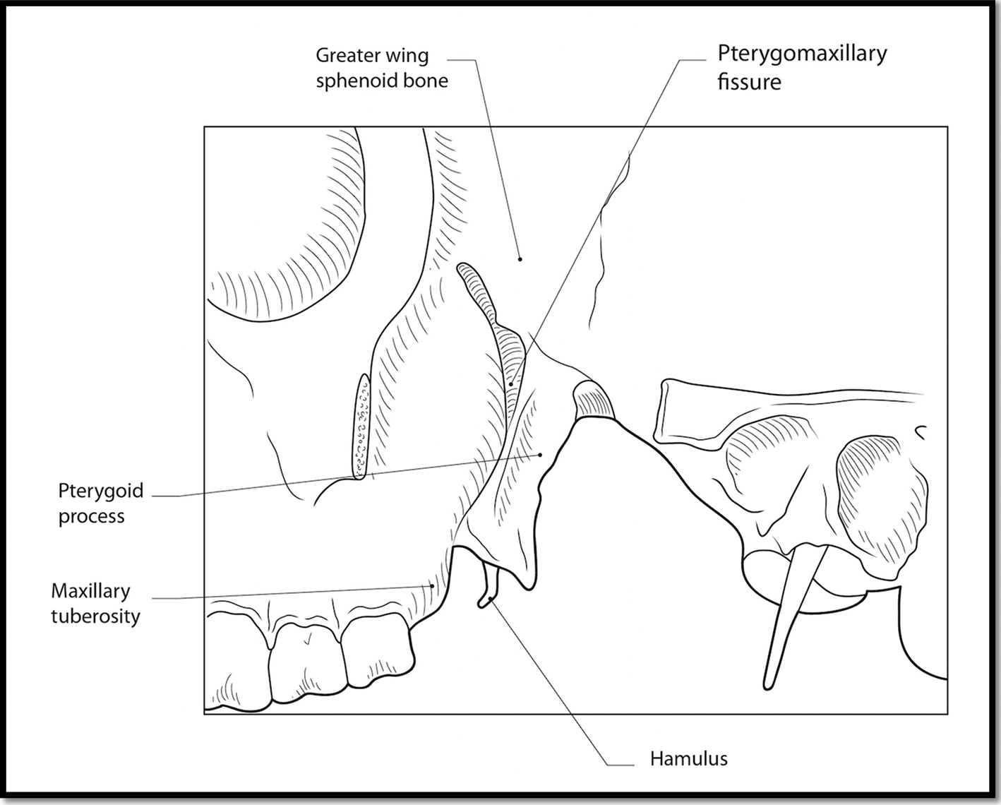 Local Anaesthetic Techniques In Endoscopic Sinonasal Surgery A Contemporaneous Review The 3122