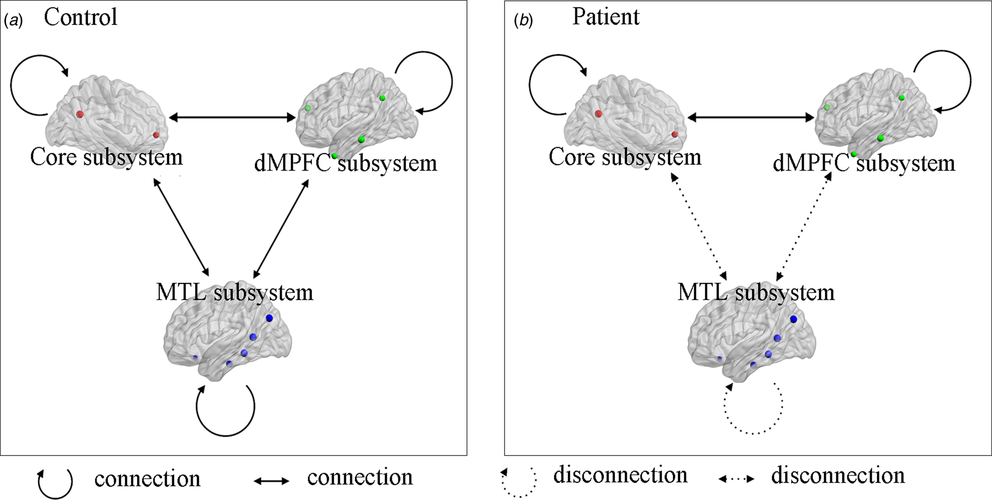 Functional disconnection between subsystems of the default mode network ...