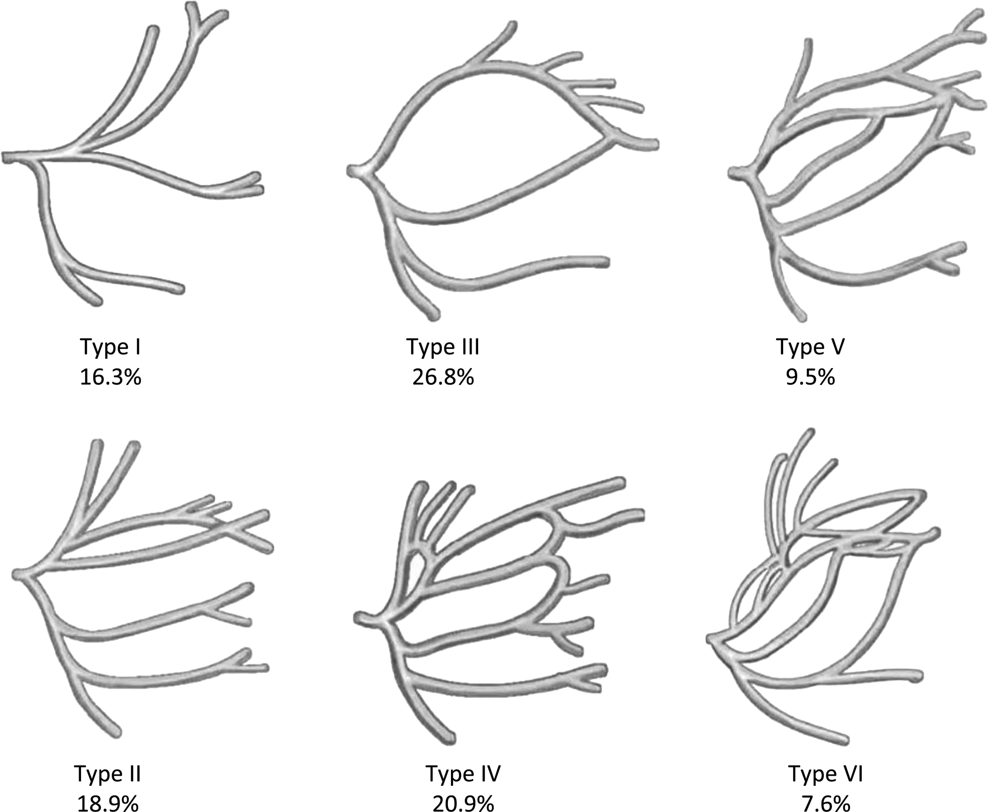 Extratemporal facial nerve branching patterns systematic review of