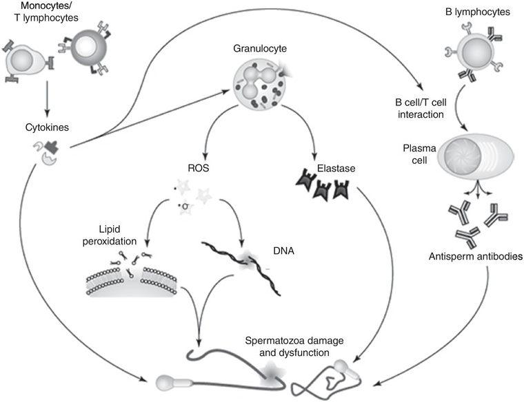 Infection In ammation and Immunological Causes of Male