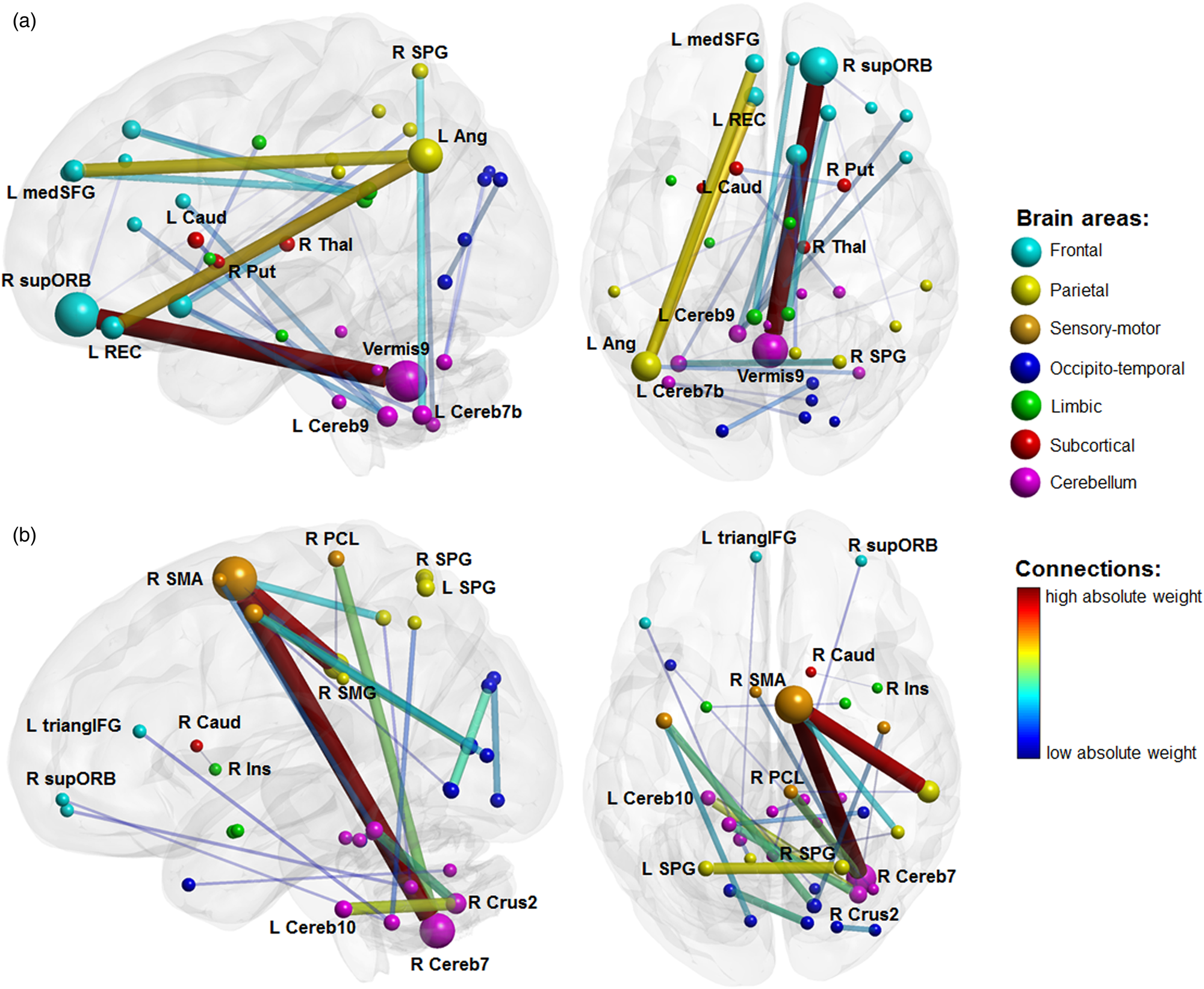 Multivariate classification provides a neural signature of Tourette  disorder | Psychological Medicine | Cambridge Core