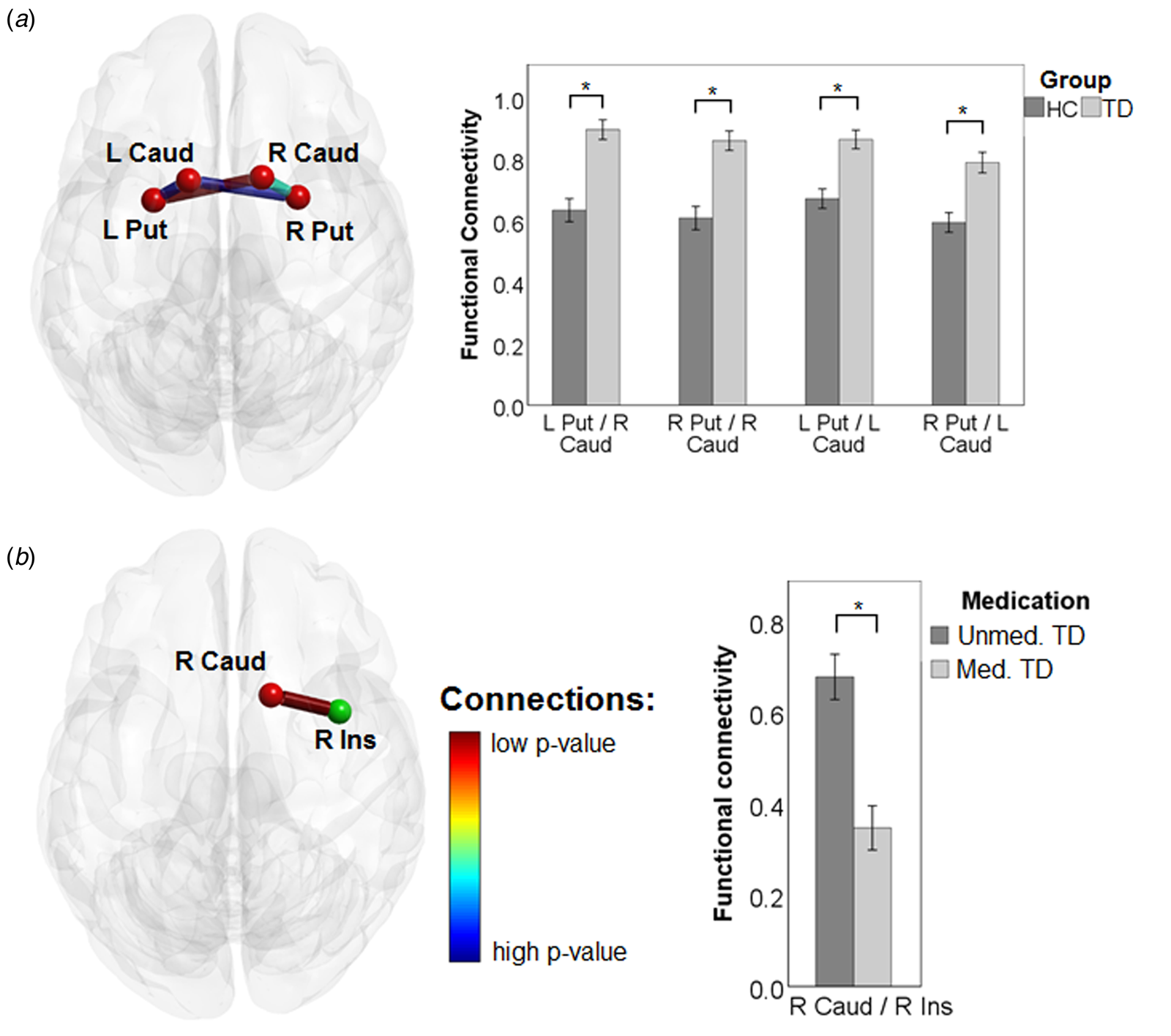 Multivariate classification provides a neural signature of Tourette  disorder | Psychological Medicine | Cambridge Core