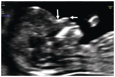 Figure 17
