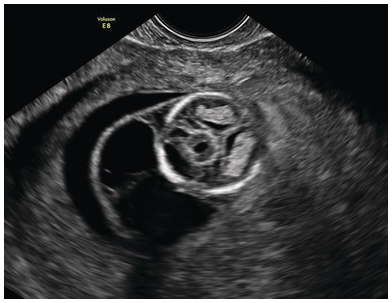Figure 27