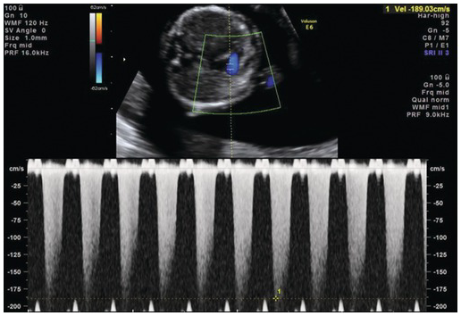 Figure 32