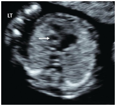 Figure 35