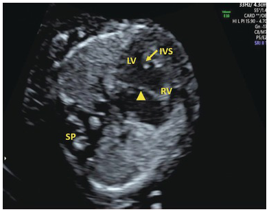 Figure 38