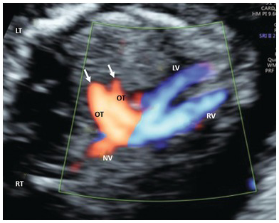 Figure 43