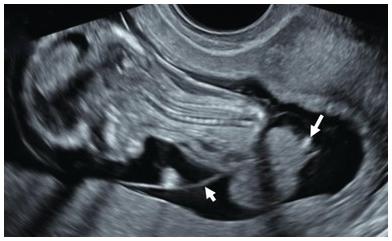 Figure 60