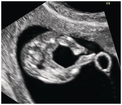 Figure 69