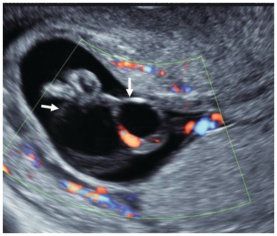 Figure 78
