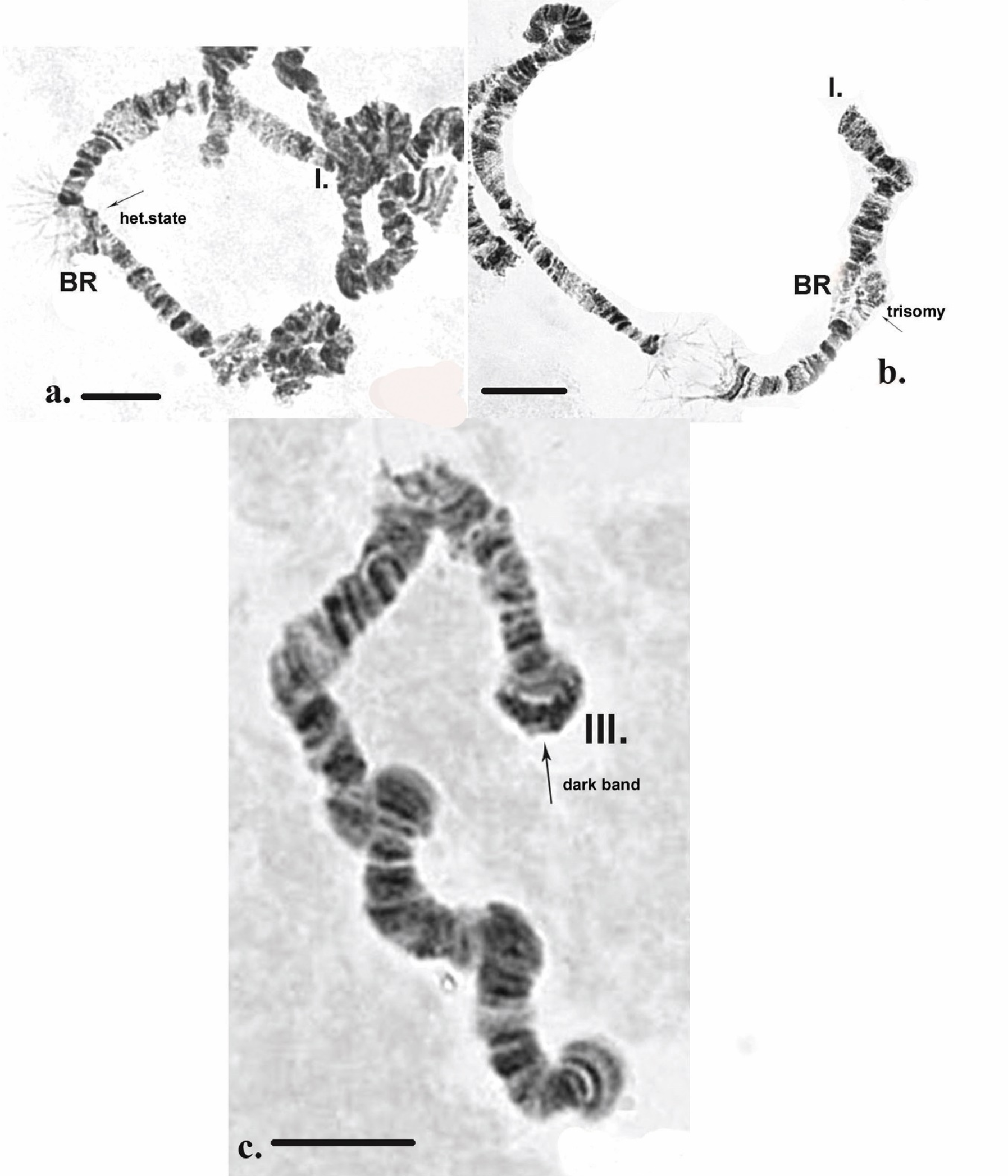 A) A representative karyotype showing 39 XX, del(5)(q15), 7, 10, 18,... |  Download Scientific Diagram