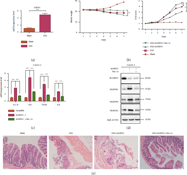 ABIN1 Inhibits Inflammation through Necroptosis-Dependent Pathway