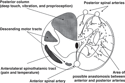 Spinal Cord Disorders Chapter 15 Obstetric Anesthesia and