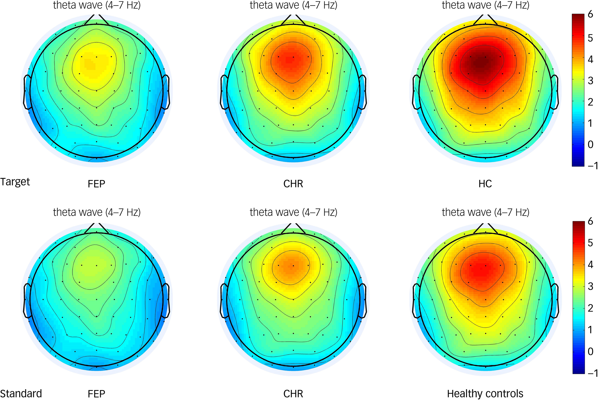 Abnormal theta and alpha oscillations in children and adolescents