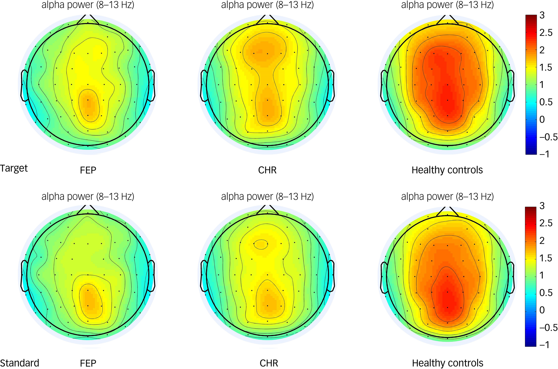 Abnormal theta and alpha oscillations in children and adolescents