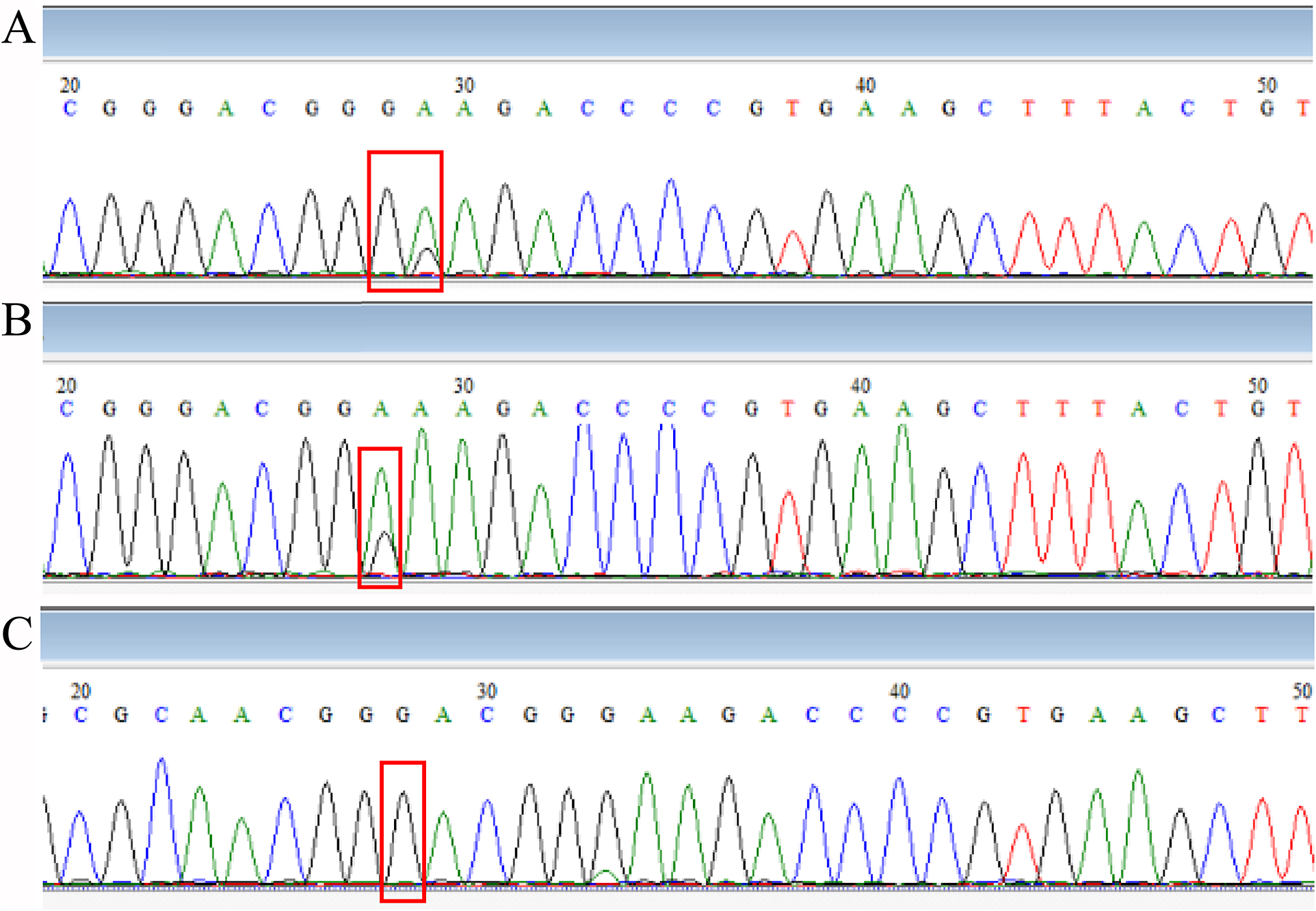 Macrolide resistance of Mycoplasma pneumoniae in several regions of ...