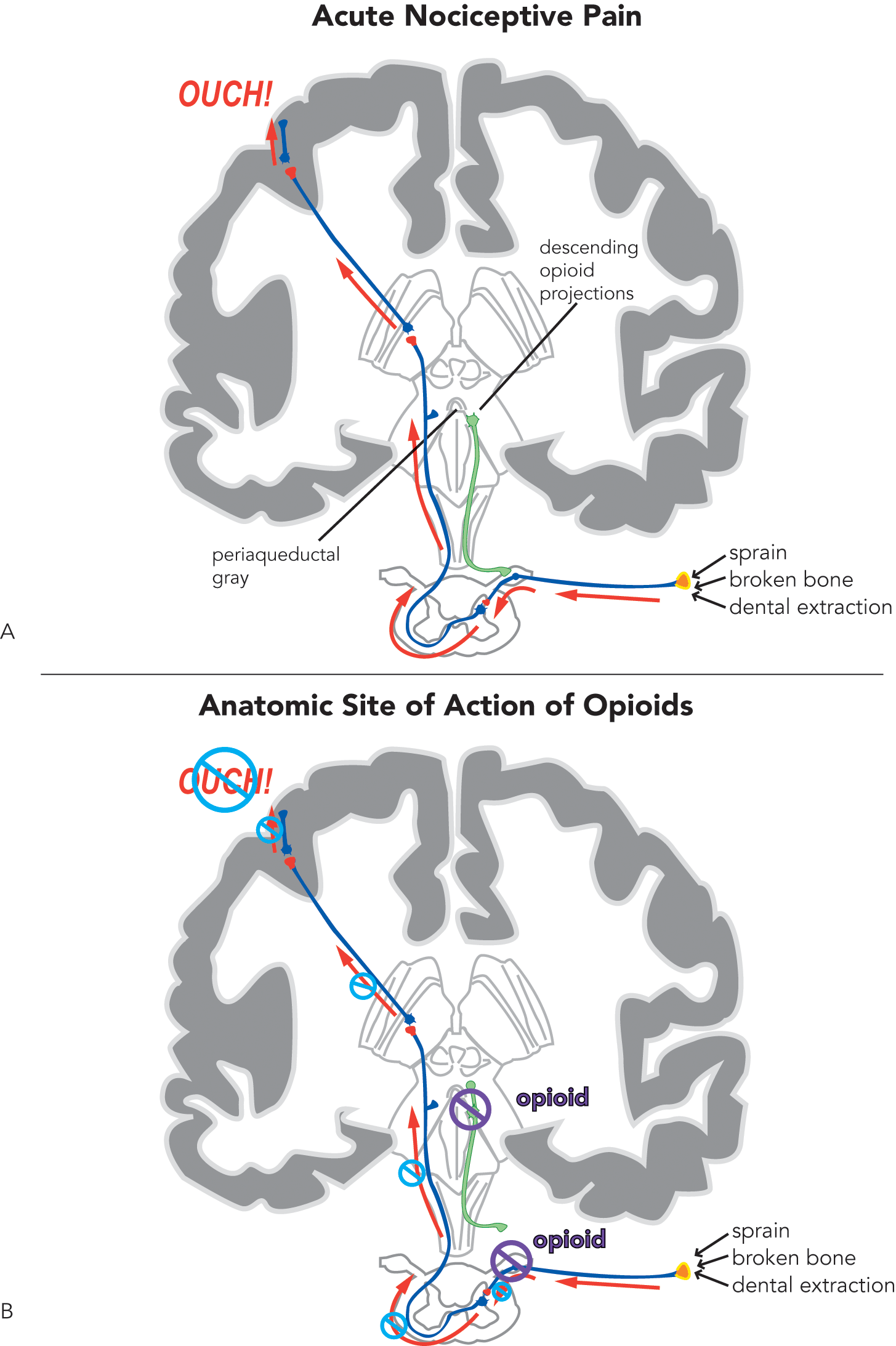 Brainstem Pain-Control Circuitry Connectivity in Chronic Neuropathic Pain |  Journal of Neuroscience, image size:1455x2186