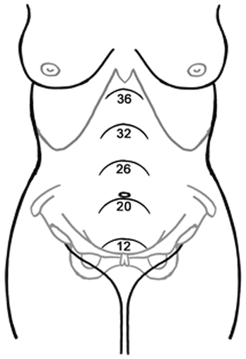 A diagram of a pregnant woman's body, showing different anatomical landmarks on the abdomen. The landmarks are marked with numerical values; 36, 32, 26, 20, and 12 from the inframammary fold to the pelvis region.