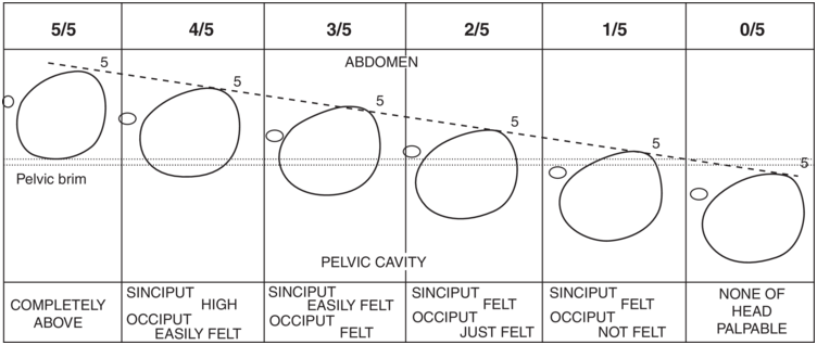 A tabular chart presents the line drawings of the descent of the heads in pelvic brim and pelvic cavity. See long description.