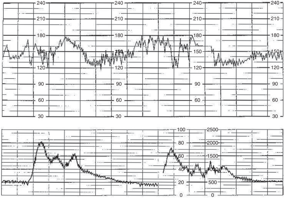 Two overlaid graphs. The top graph displays a fluctuating line. The vertical axis shows values ranging from 30 to 240. The bottom graph displays a fluctuating line with values ranging from 0 through 100 and 0 through 2500.