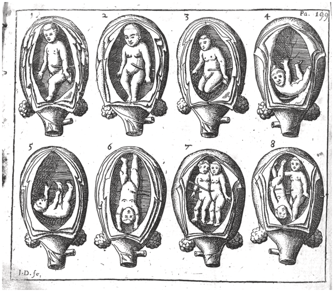 A historical black-and-white engraving illustrating different fetal positions inside the womb. It features eight depictions of fetuses in various orientations within a cross-section of a uterus. See long description.